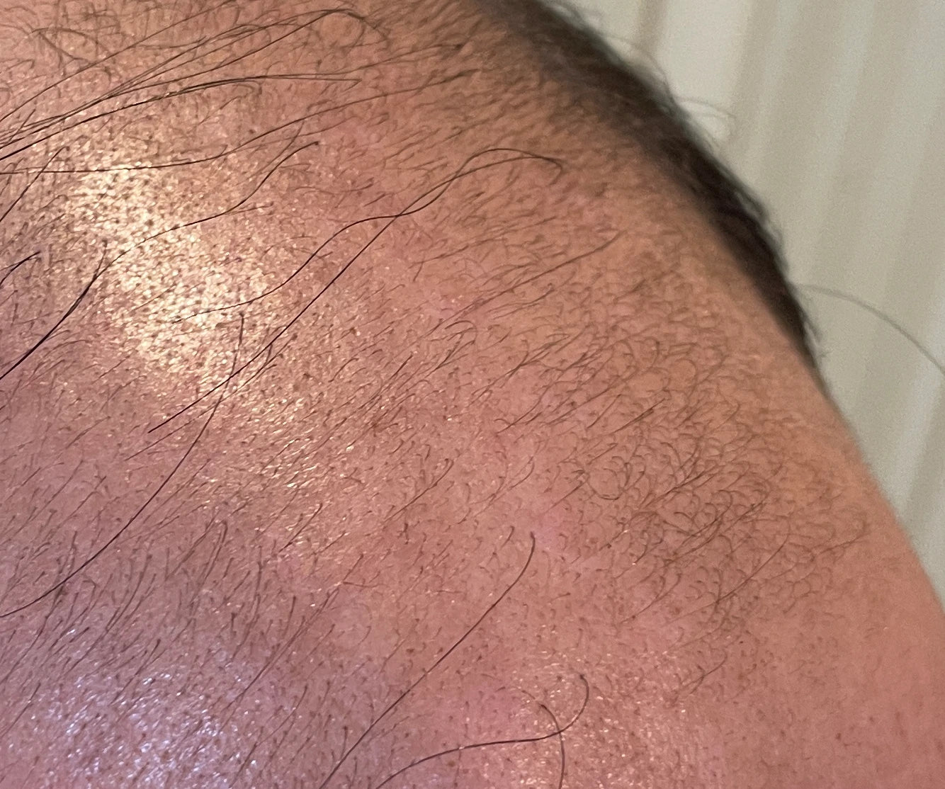Close-up result showing new baby hairs
