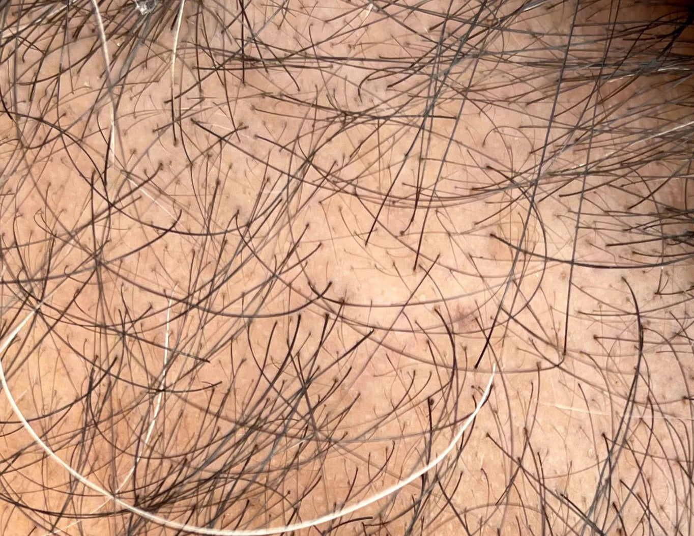 Before photo showing hair density