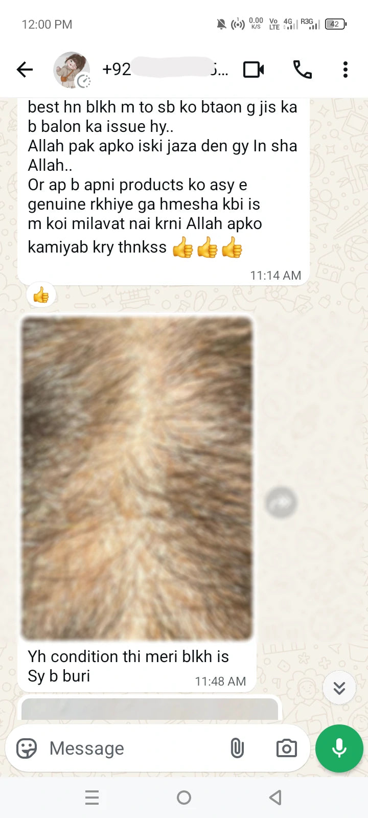 Close-up showing improved hair density